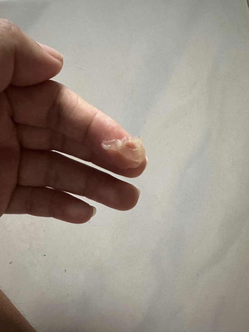 สอบถามแม่ๆค่ะ