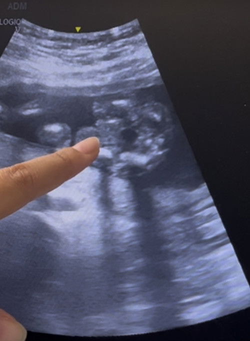 แม่ๆคิดว่าหนูเพศไหน