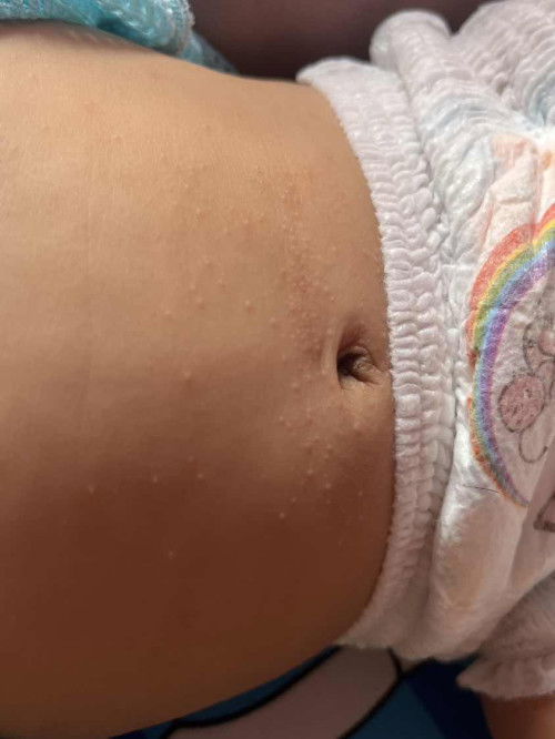 เเบบนี้น้อบเป็นอะไรค่ะเเม่ๆ🥲