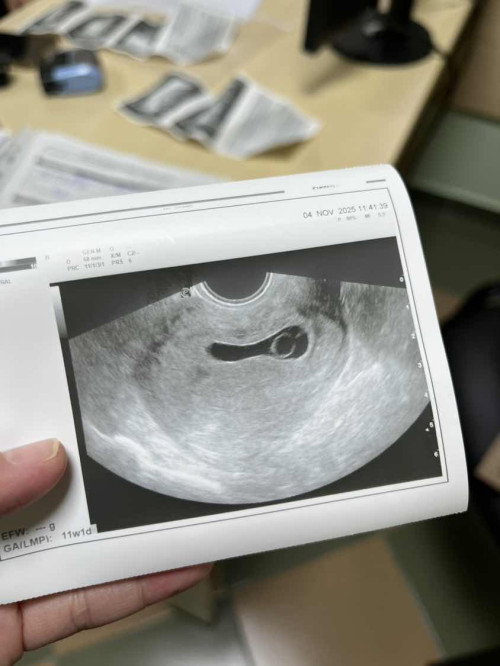 10weeks pregnant