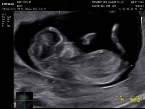 đoán vui giới tính