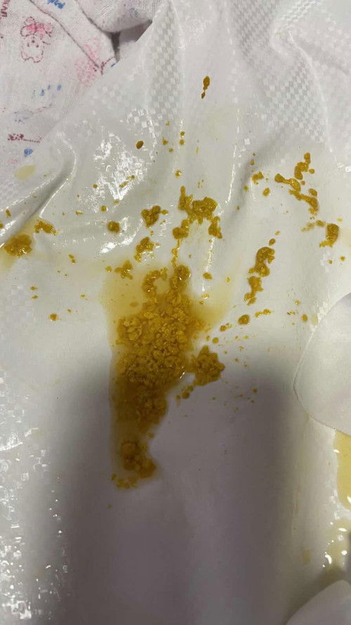 แบบนี้ น้องท้องเสียไหมคะแม่