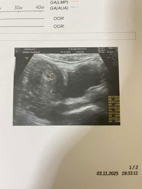 ไปห้องฝากครรภ์เข้ายังไม่รับฝากค่ะ