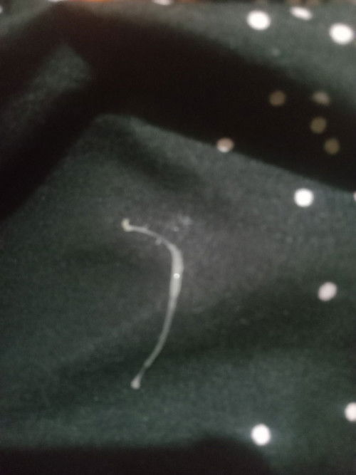 แบบนี้มุกหรือตกขาว