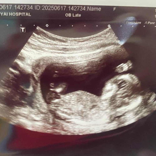 รูปภาพซาว์ดูเพศ