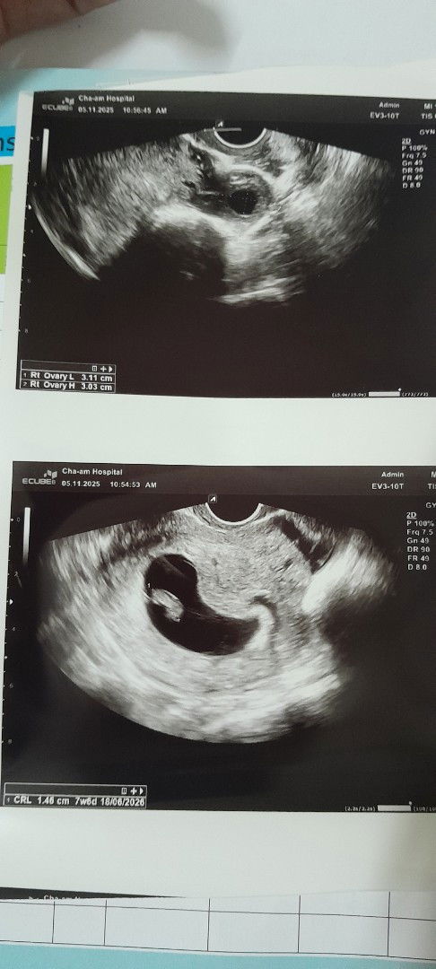 7w6dไม่เจอหัวใจน้อง