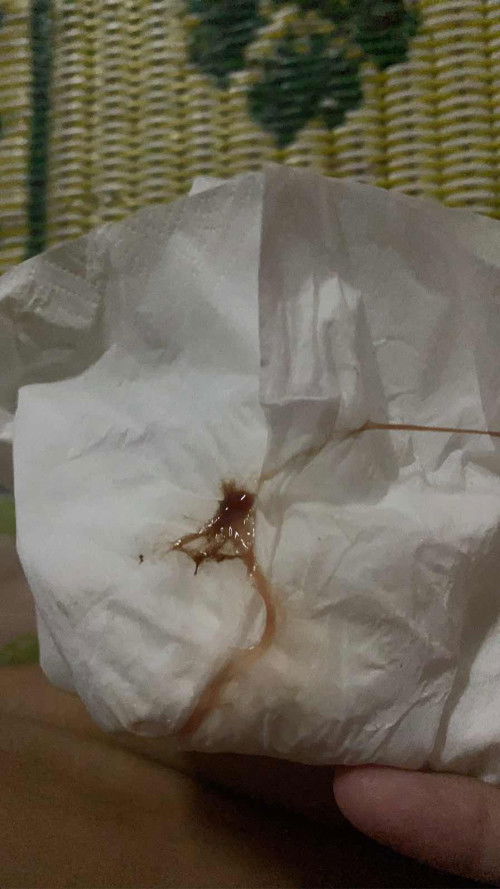 สอบถามค่ะ 35+3