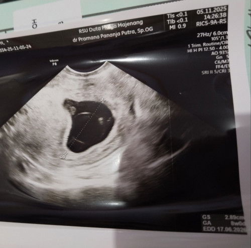 Kehamilan 9w