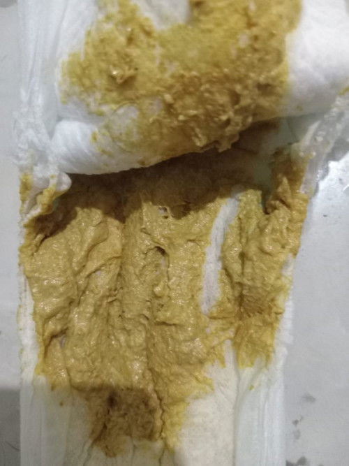 Diare, peralihan susu 1+ (usia 13 bulan)