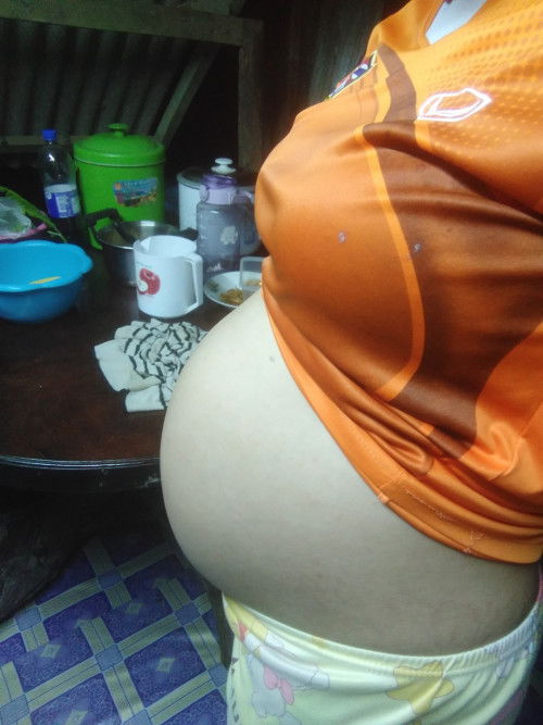 ลองทายกันดูคะท้องแบบนี้ผู้หญิงหรือชายคะ ไปอัลตร้าซาวด์แล้วนอนหนีบขานอนคว่ำหน้า