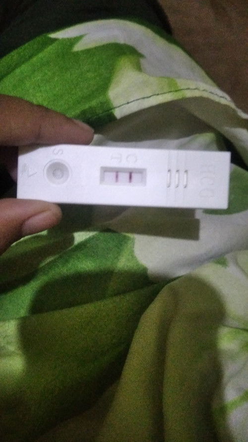 Anak pertama usia 2 thun melakukan sc skrg hamil ke 2 apa beresiko