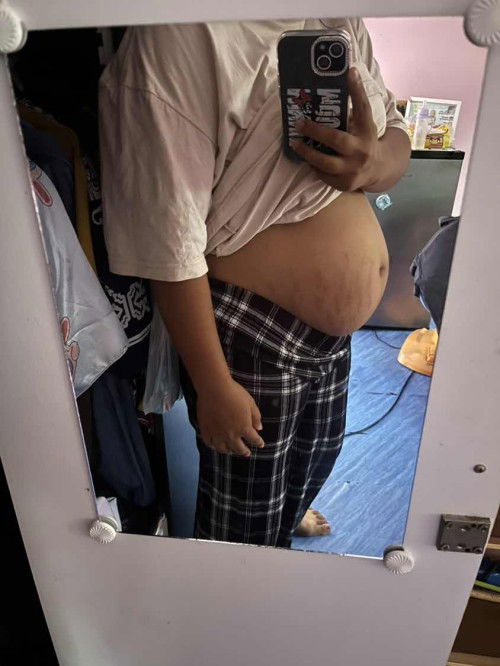 ท้องสอง17+4