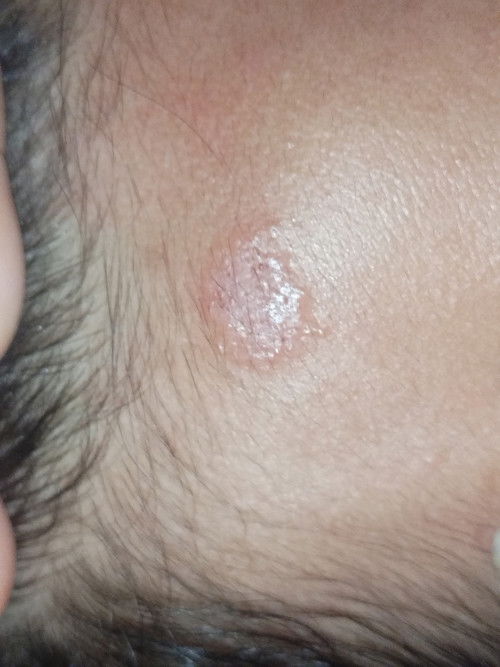 Ano kaya ito mga Mi?