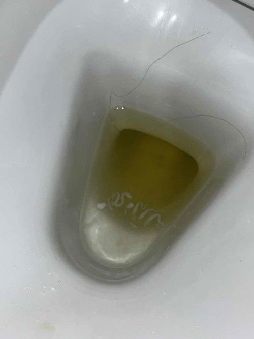 White creamy discharge