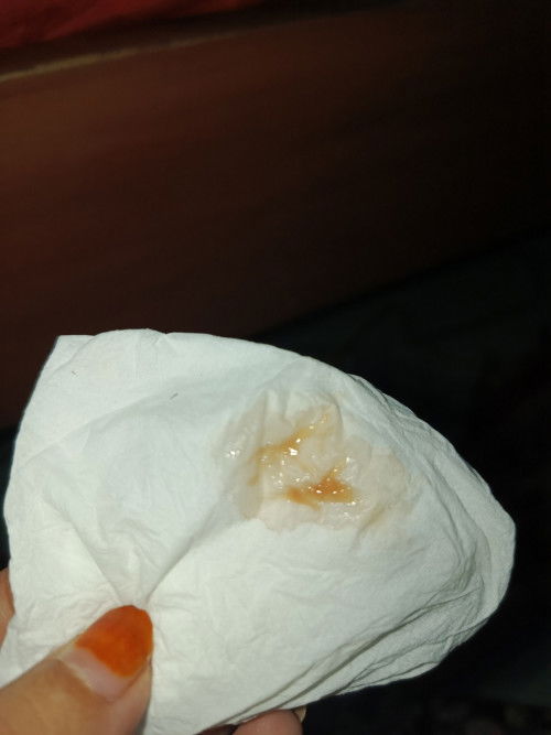 Darah campur lendir di usia kehamilan 38 week lebih