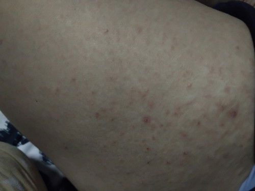 สอบถามหน่อยจ้า ท้องแรก 9w3d