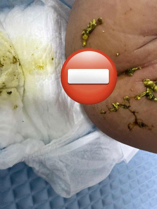 Najis baby breastfeeding