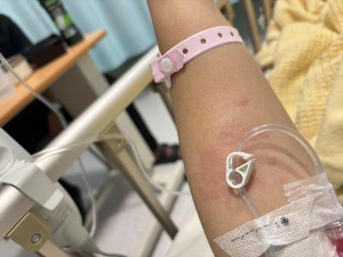 9w satu badan gatal gatal