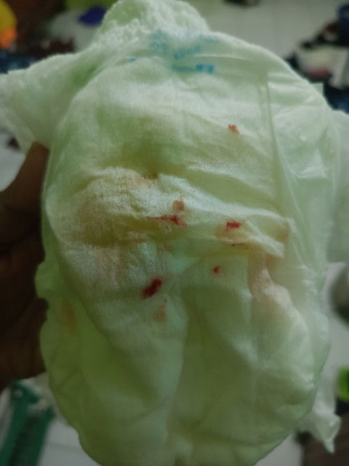 Ada yang tau ini kenapa??