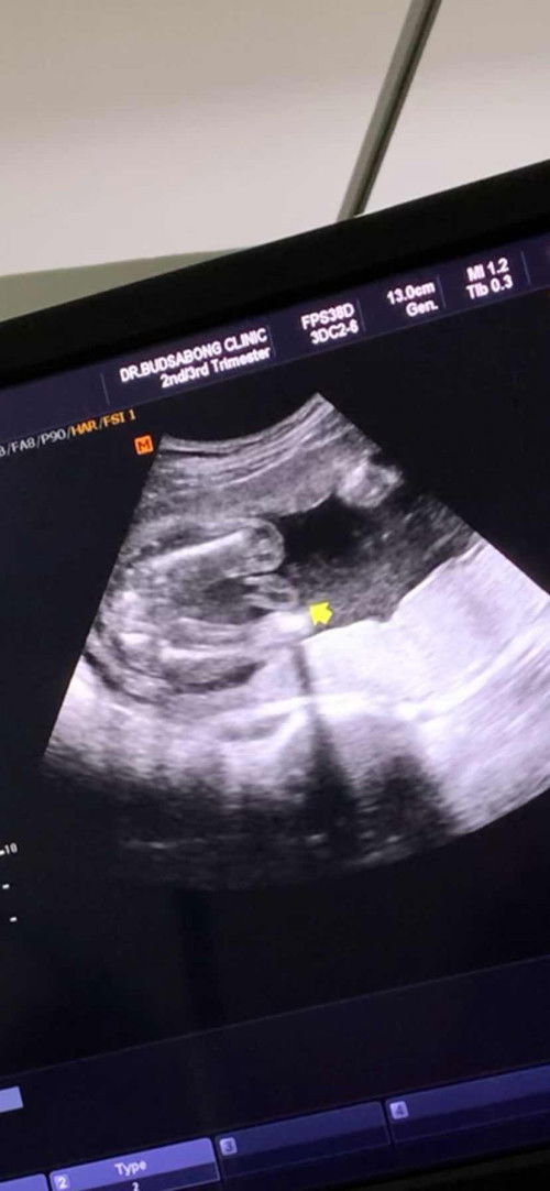 อยากรู้เพศน้อง🥹