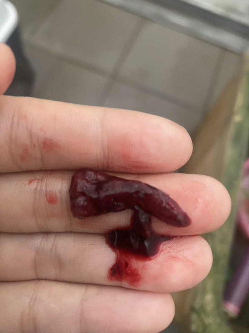 ขอคำแนะนำำหน่อยคะ