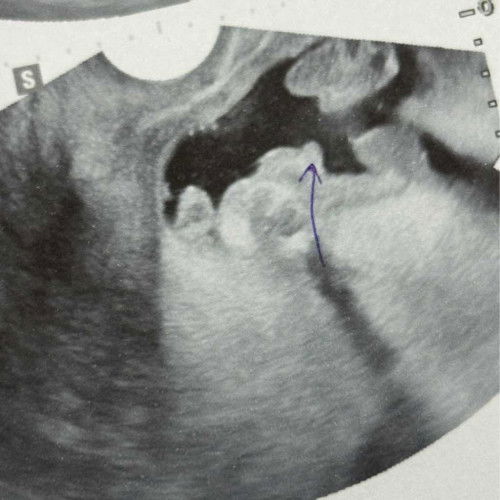 ทายเพศกันค่ะ