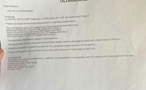 Ano po kayang ibig sabihen nito monday papo kase balik ko sa ob