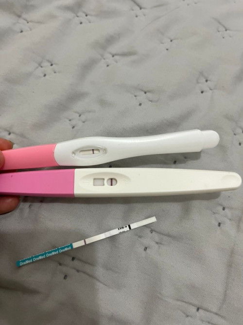 USG ADA KANTONG KEHAMILAN, TESPEK NEGATIF