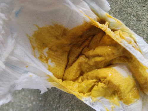 ถ่ายเป็นมูก