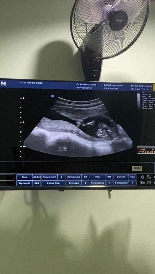 ขออนุญาตค่ะแม่ๆคุณหมอคอนเฟิร์มว่าเป็นจู๋มีสิทธิ์เปลี่ยนทีมไหมคะแบบนี้