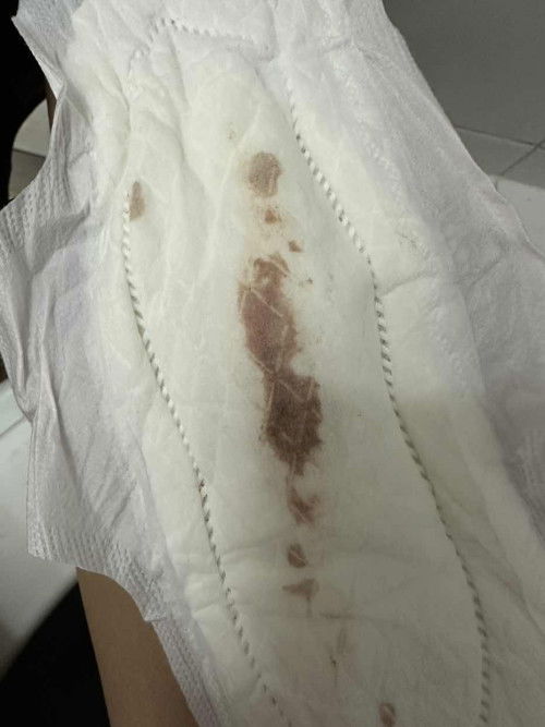 ตั้งครรภ์ได้ 8 สัปดาห์