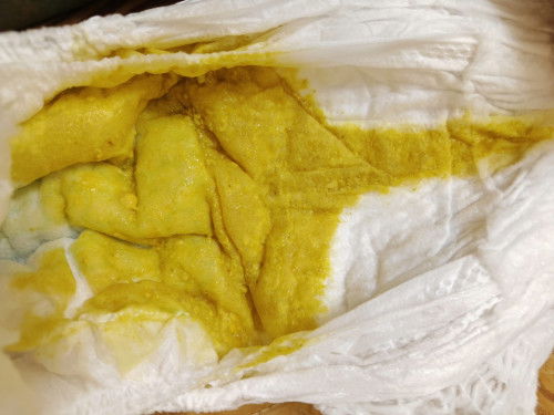 น้อง4เดือนอึแบบนี้ปกติมั้ยคะ