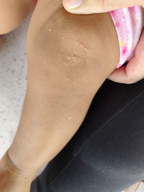 สอบถามแม่ๆค่ะ