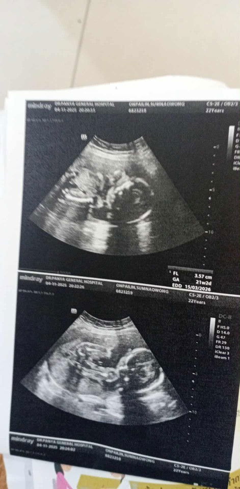 อยากรู้ว่าน้องตัวใหญ่มั้ยคะ