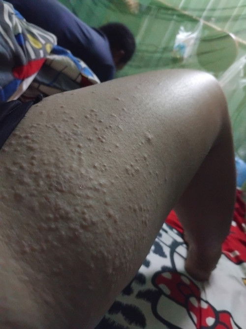 ท้องแรกแอบกังวล