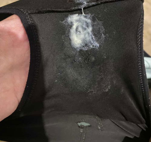 แบบนี้ใช่มูกมั้ยคะตอนนี้มีอาการปวดหน่วงลงที่ขา ท้องปั้น