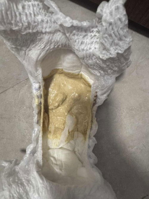 Two year old light yellow watery stool