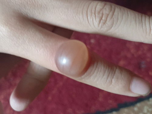 Ada sesiapa yg pernah alami?  Apa ubat paling berkesan menggunakan bahan semulajadi