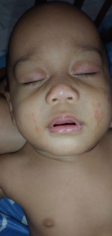 มีลูกบ้านไหนเคยเป็นมั้ยคะ