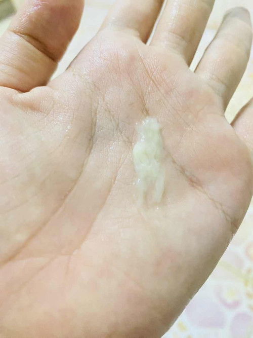 แบบนี้ปกติมั้ย ท้องจะ34wแล้วค่ะ