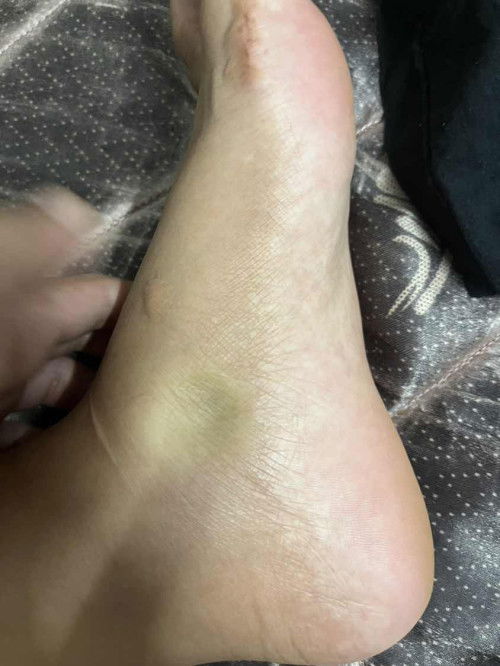 ใครเคยมีประสบการณ์แบบนี้บ้างคะ