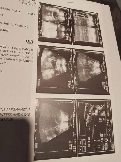 Sure na po bang boy?