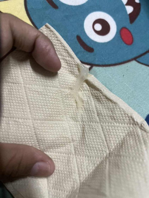 สอบถามค่ะ มี ลักษณะแบบนี้ออกมาแต่นานๆทีจะเป็น ปกติไหมค่ะ 🥹