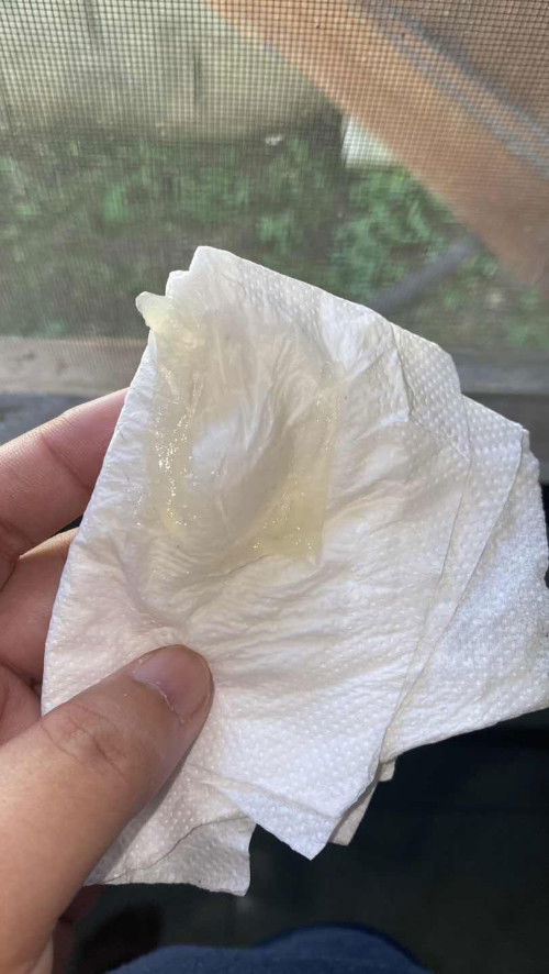 มีมูกใสๆออกมา 39+2