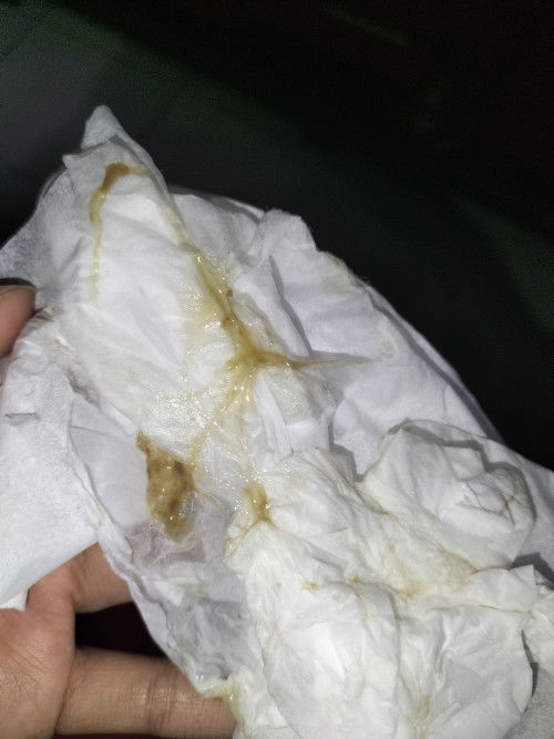 Lendir diusia 39 Minggu