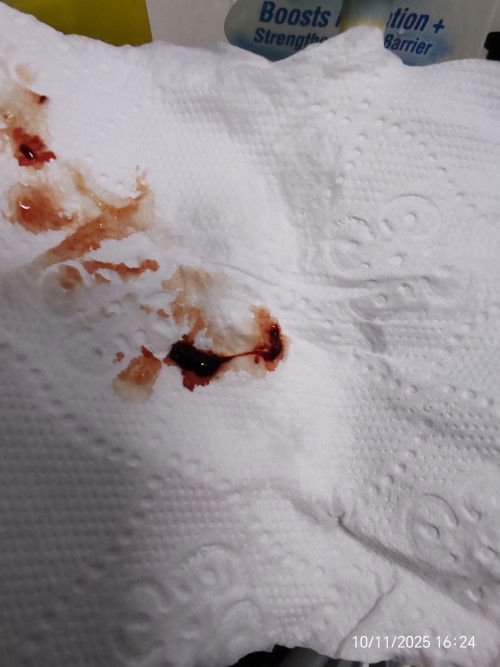 Hello mommy ada tak mcm sy, keluar darah mcm ni sikit je, tapi tak sakit langsung..