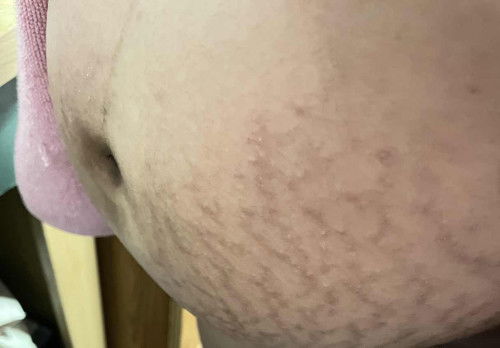 สอบถามค่ะ แบบนี้อันตรายไหมคะ ต้องรีบไปหาหมอไหม