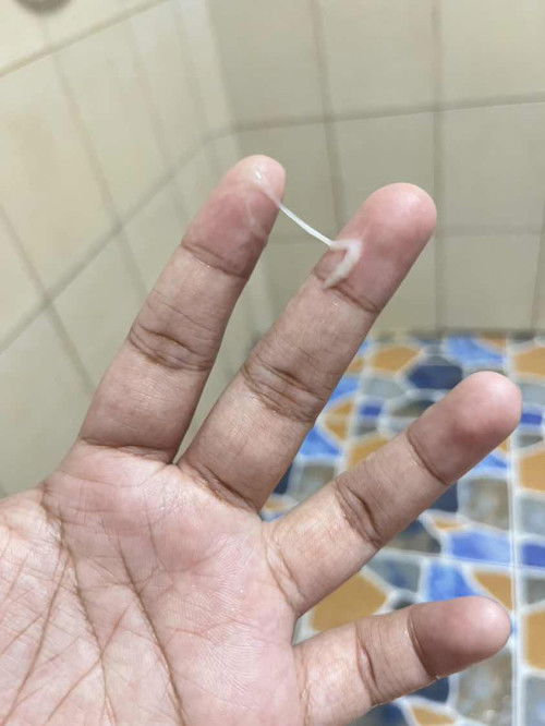 แบบนี้ต้องไปหาหมอไหมคะ 35+5w