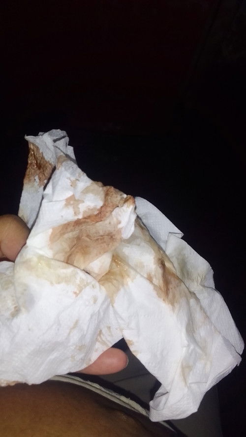 32 weeks keluar lendir sama darah tanpa ngerasain sakit sebelumnya kira-kira aman ngga Bun??