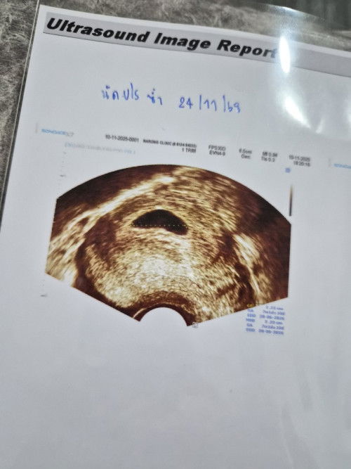 สอบถามค่ะใครเคยมีประสบการณ์บ้างไหมคะ